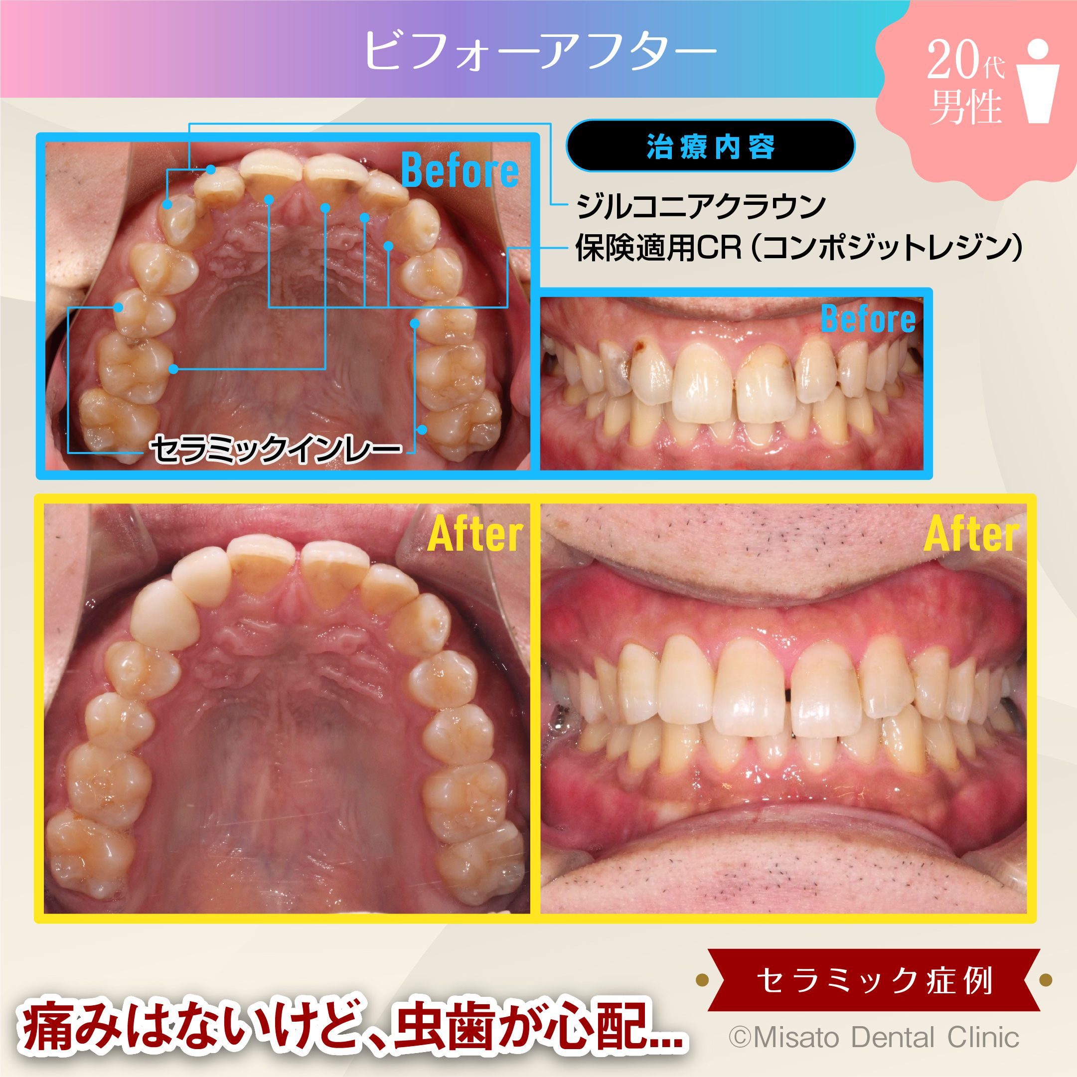 ビフォーアフター