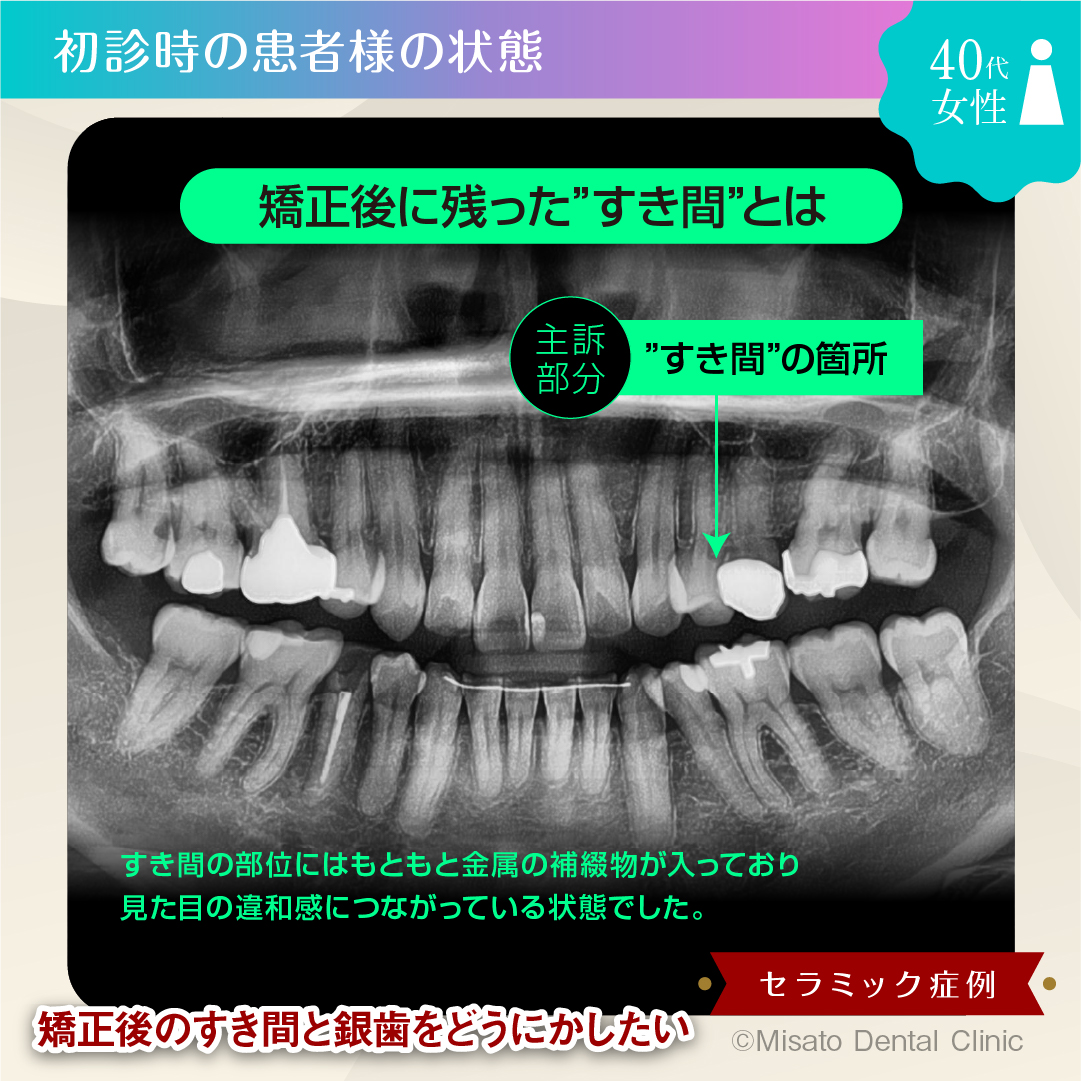 初診時の状態（レントゲン