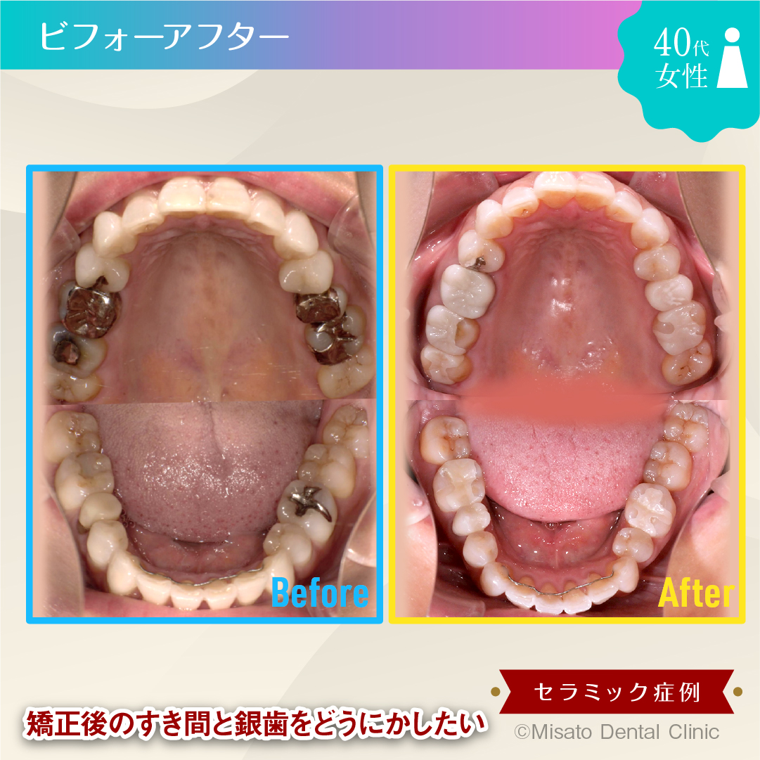 ビフォーアフター