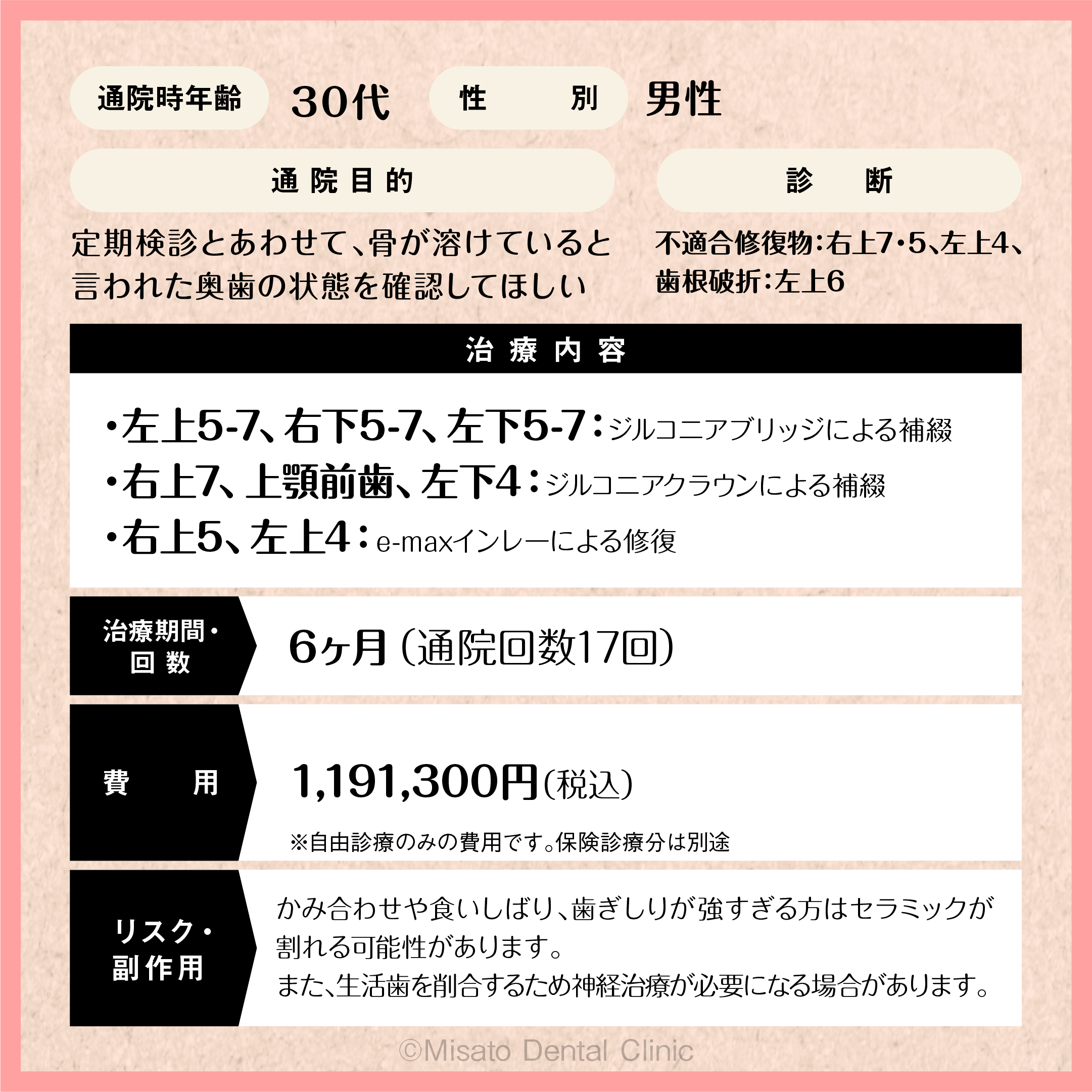 限定解除項目