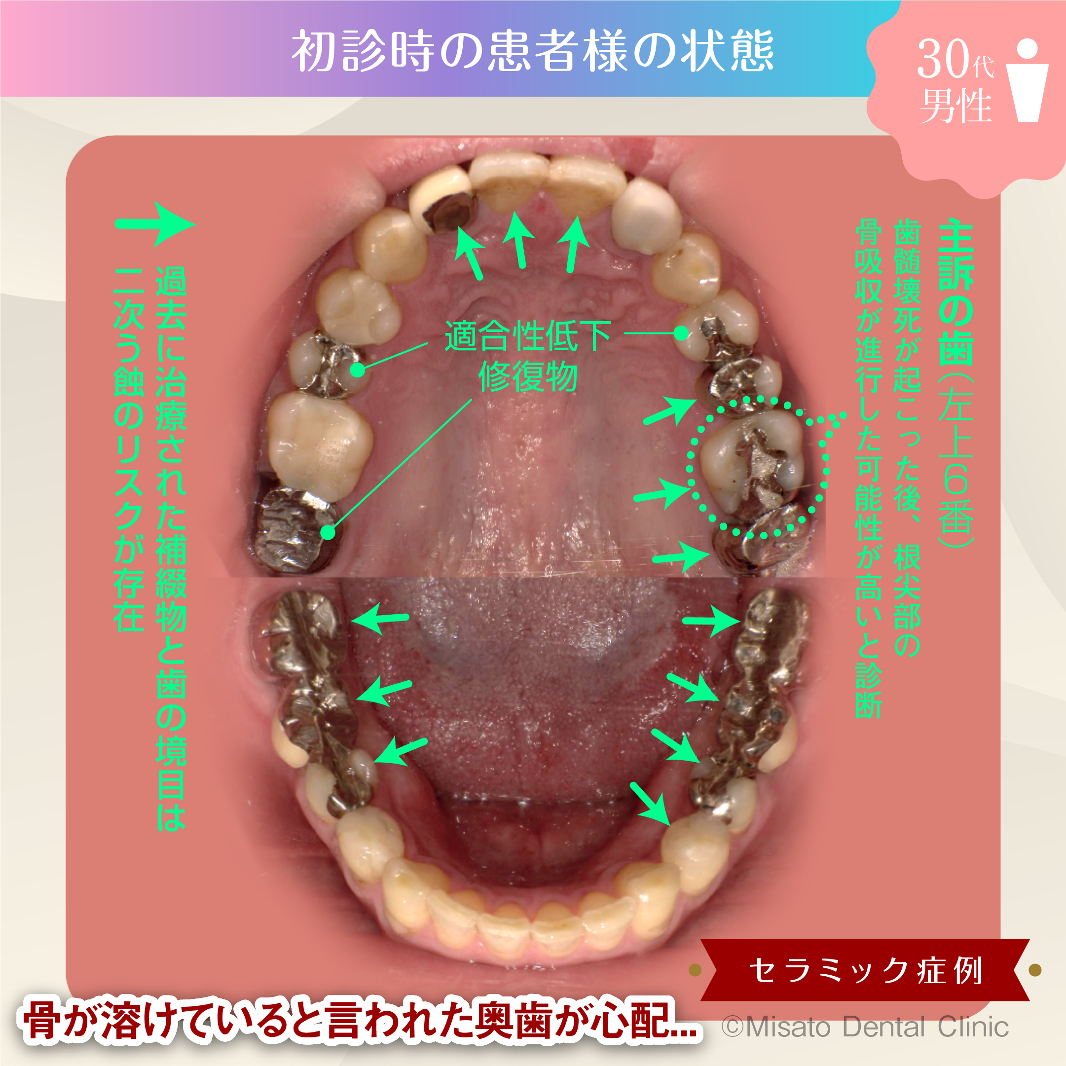 初診時の患者の状態