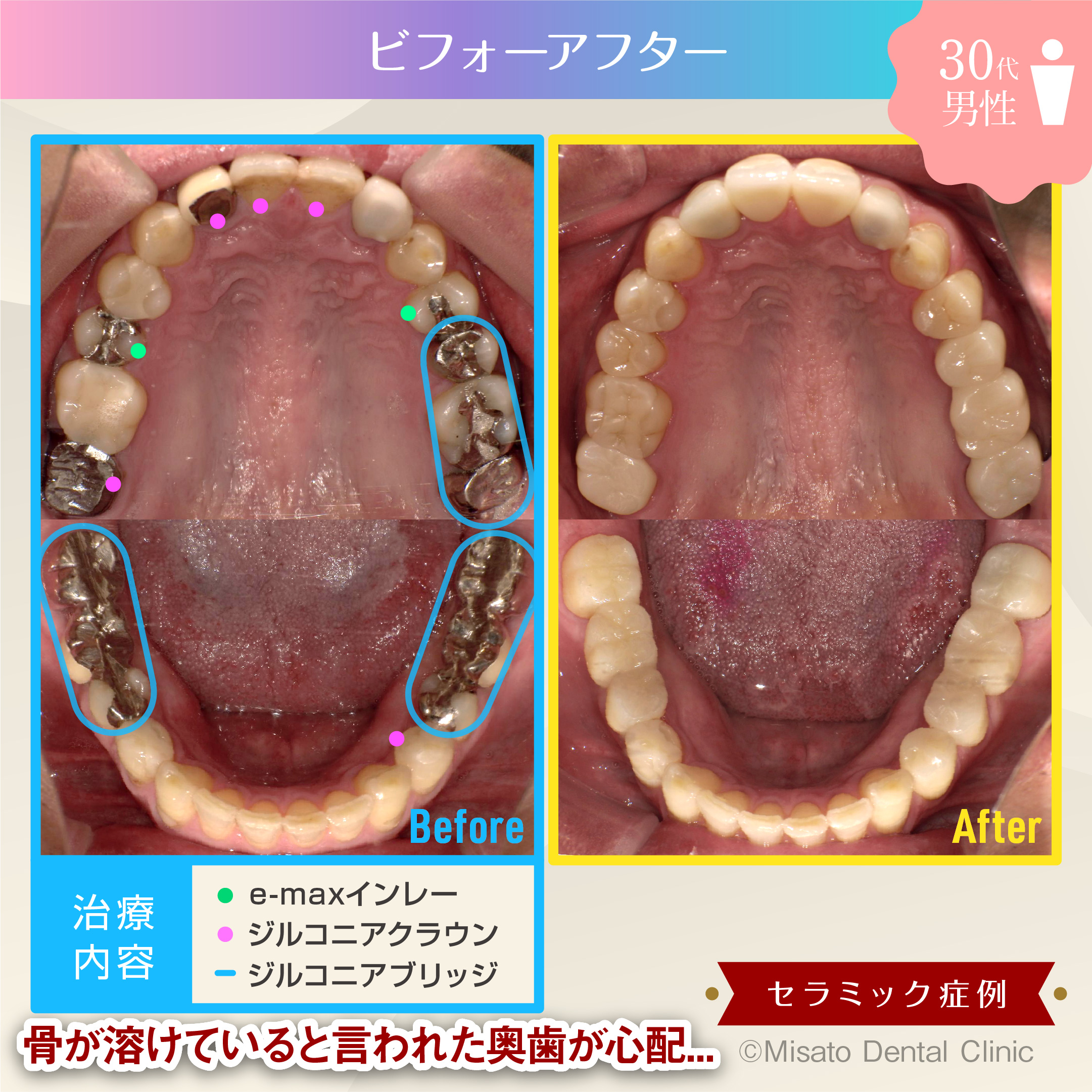 ビフォーアフター