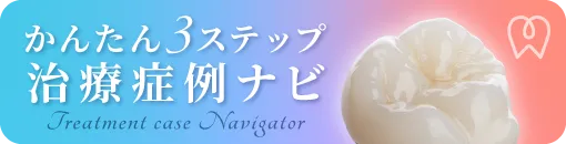 みさとデンタルクリニック 治療症例ナビ
