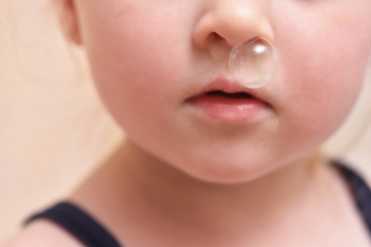 鼻づまりで口呼吸をしている子ども